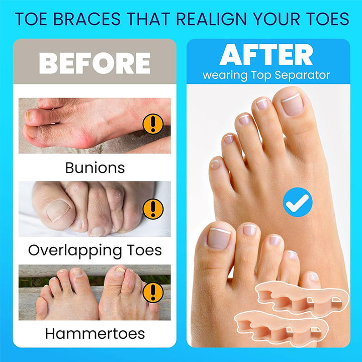 Five pairs of gel toe separators, neatly arranged, indicating a bulk pack for ongoing foot care.