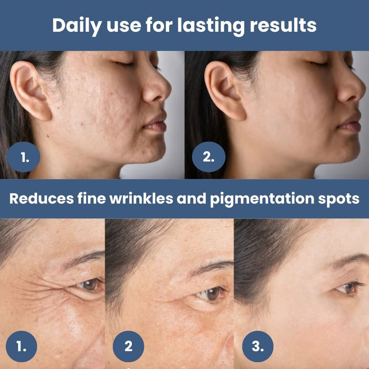 "Unisex LED light therapy mask for youthful skin, featuring advanced LED lights, ergonomic design, and multiple light modes."