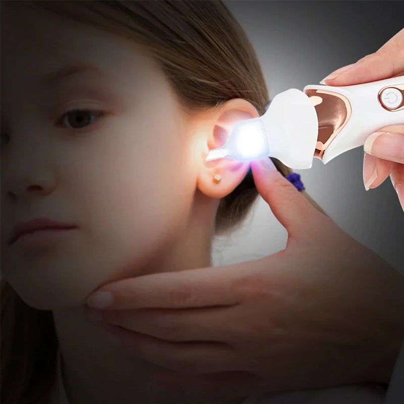 Electric ear wax remover with LED light for clear visibility during ear wax removal. Enhanced ear scoop.