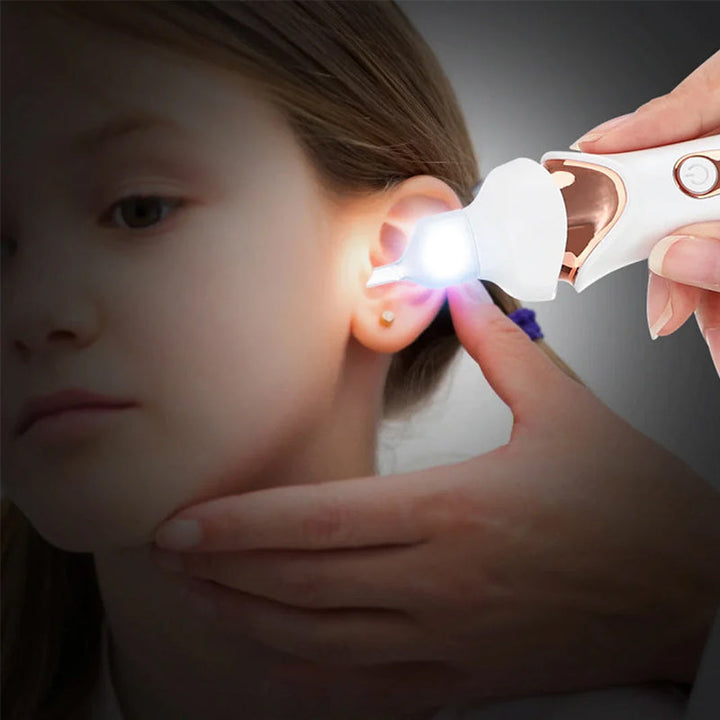 Electric ear wax remover with LED light for clear visibility during ear wax removal. Enhanced ear scoop.