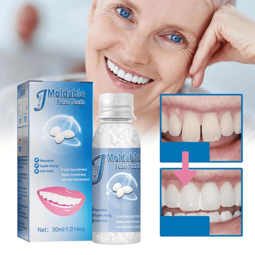 Instant Smile Temporary Dental Repair Beads for molding emergency tooth filling, fixing missing teeth & gaps. Cosmetic dentistry solution.