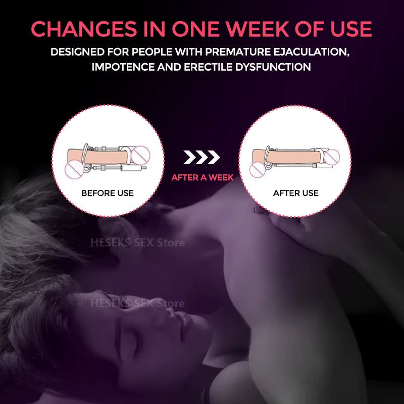 Instructional image of the men's performance enhancer traction device, promoting natural growth.