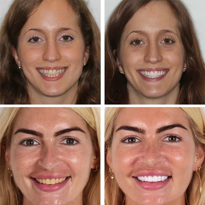 A vibrant image of probiotic whitening toothpaste, emphasizing a brighter smile and fresh breath.