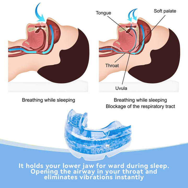 BPA-free anti-snore dental guard, a custom fit mouth guard for men & women seeking snoring relief and better sleep.
