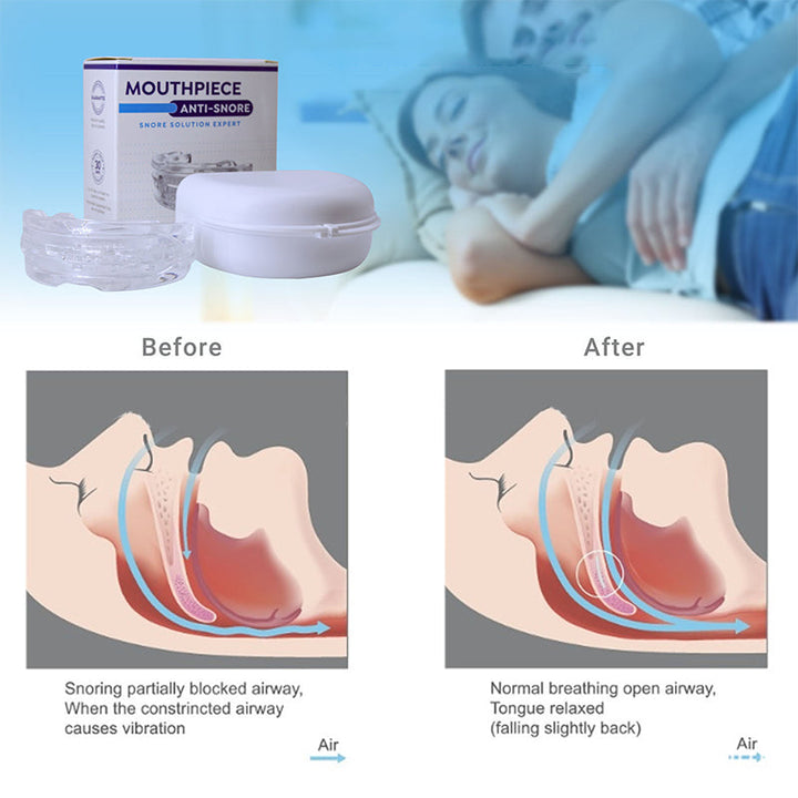 Unisex Custom Fit Anti-Snoring Mouth Guard for Peaceful Sleep