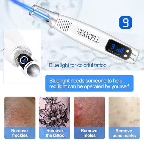 Sleek laser pen for non-invasive skin treatment. Target tattoos, moles, & freckles for clear skin.