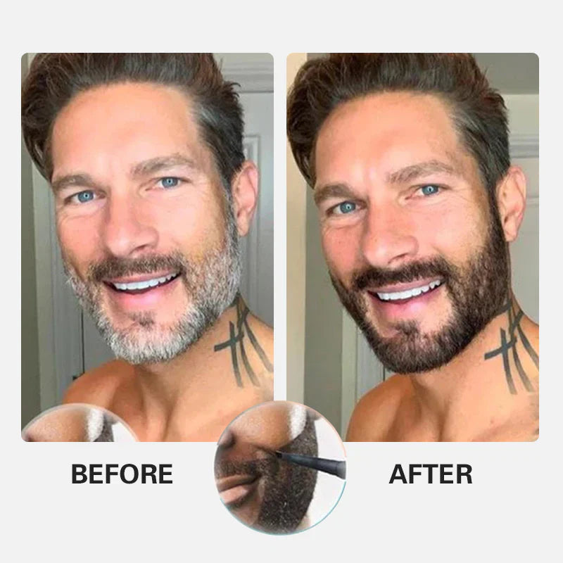Before and after, showing a fuller, more defined beard with the microblading pen